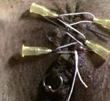 Closed Cunt - I let my slut lay down on the bondage couch and put four medium-sized needles trough her outer labia. She has a lot of pain. Watch your ears, because this slave **** can really scream! I connect a thin line around the needles. The cunt is now completely closed